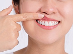 Woman showing off her gums