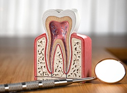 Dental mirror and model showing inside of tooth