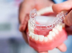 Dental model and clear aligner against blurred background