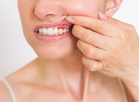 Woman with red and swollen gums