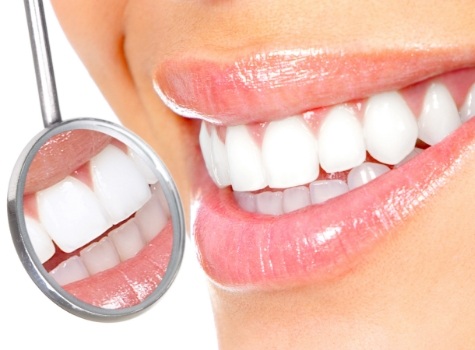 Opalescence Teeth Whitening Hoover, AL, Cosmetic Dentist