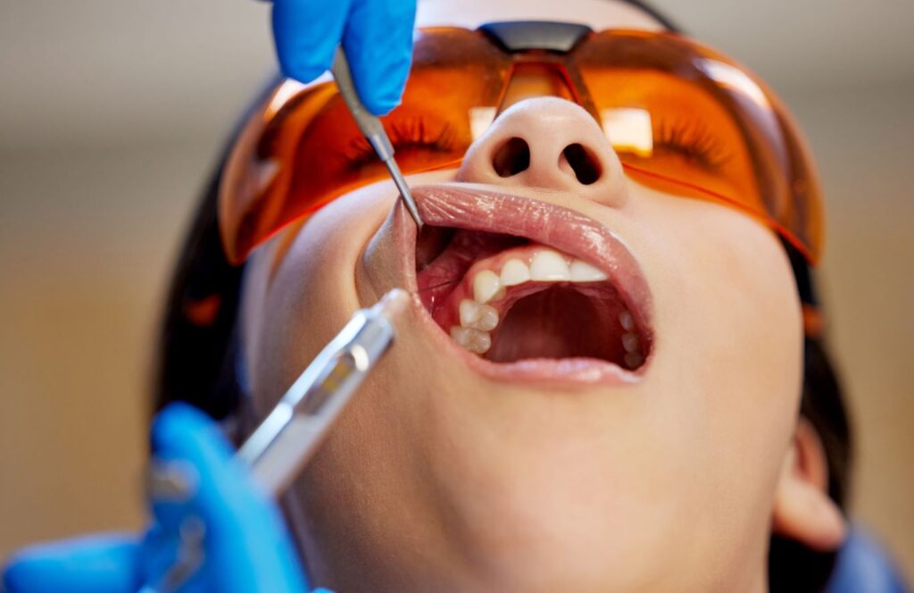 An woman getting her teeth examined by a dentist.